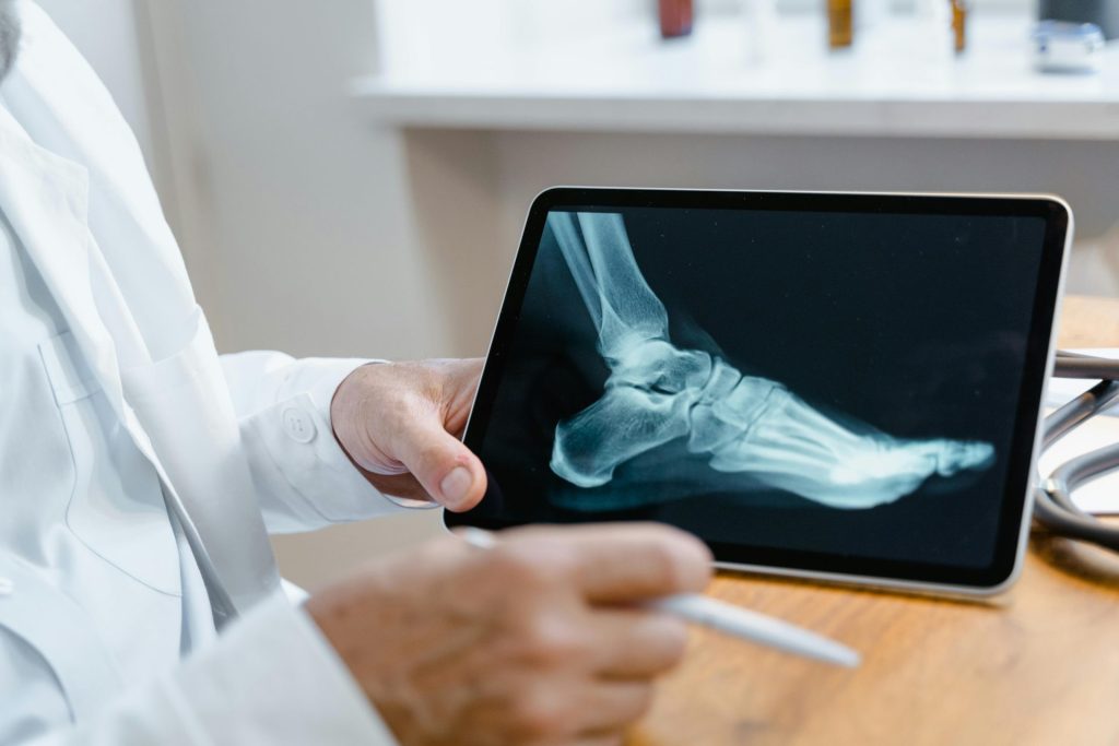 Doctor examining a foot X-ray image on a digital tablet using a stylus in a medical office.